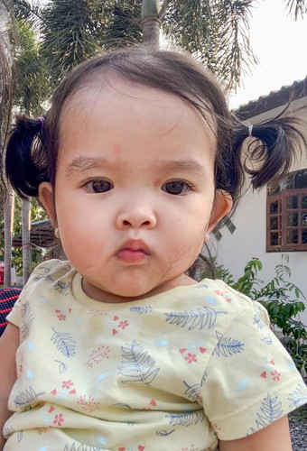 อาการฟันจะขึ้นเป็นยังไงกันบ้าง