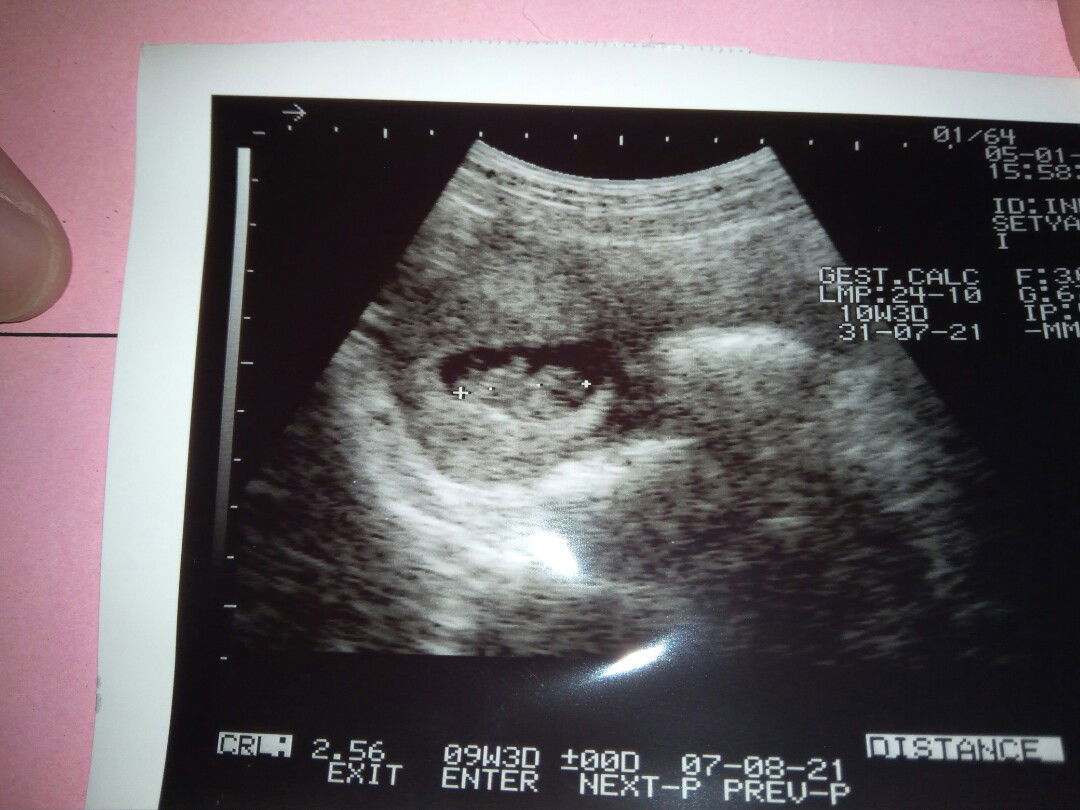 Indah Cristyana putry profile icon