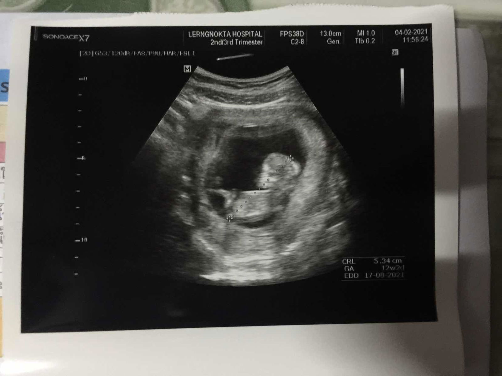 ratthana kongjam profile icon