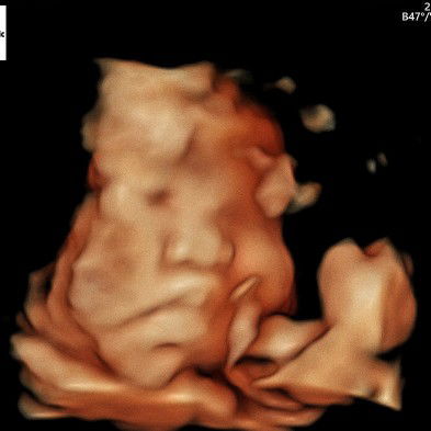 Harti wahyu Setiyawati profile icon