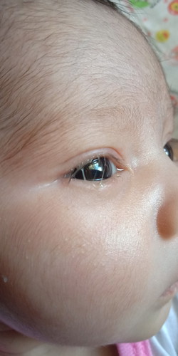 belekan bayi