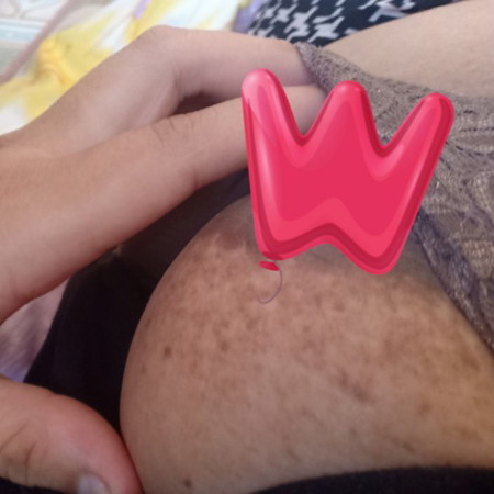 ลานนมเป็นจุด