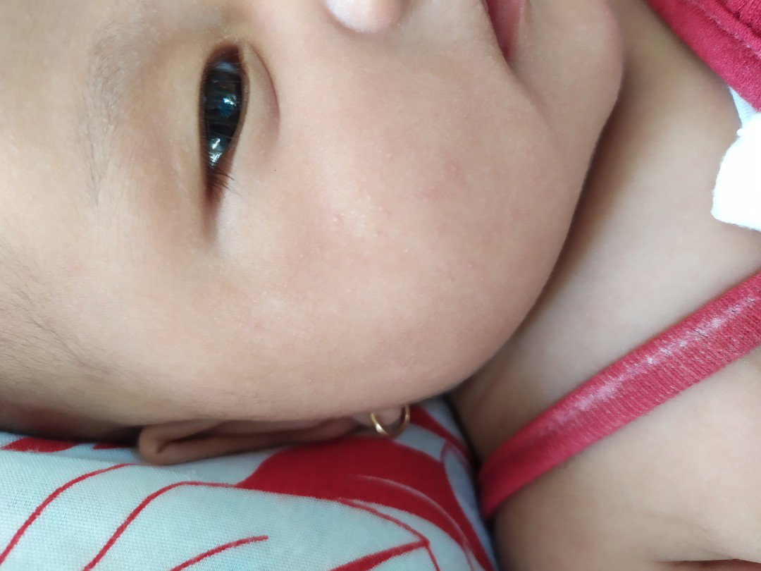 kulit kering