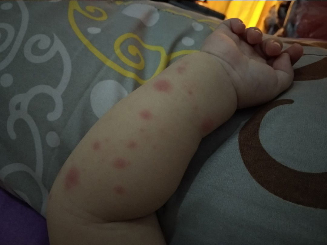 alergi atau apa yach?