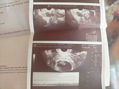 lourin&luigi baby profile icon