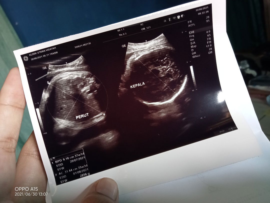 Tanggal perkiraan lahir