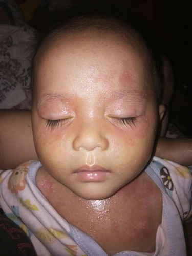 bintik2 merah merah kasar