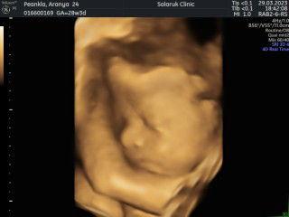 aranya peankla profile icon