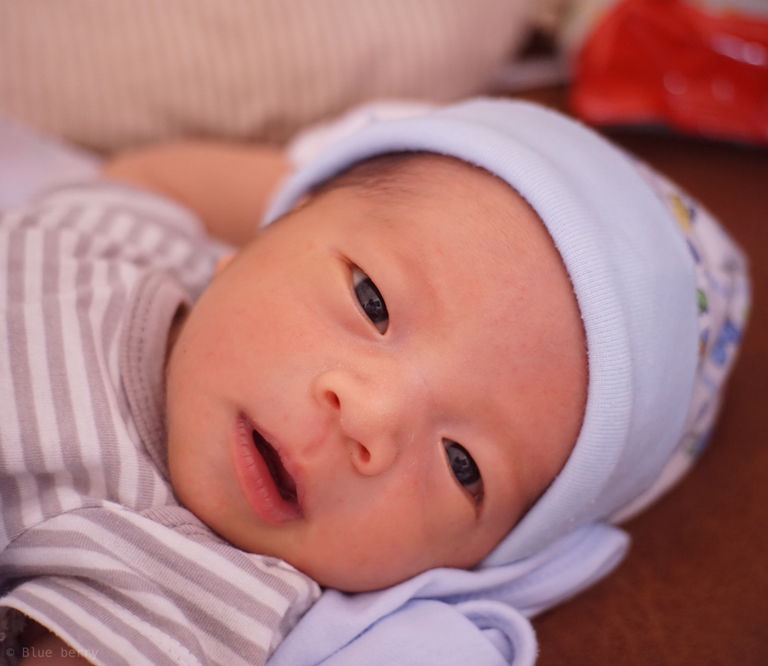 ลูกอายุ 12 วัน เป็นขี้ตาแฉะ  นวดท่อน้ำตาแล้วไม่หาย