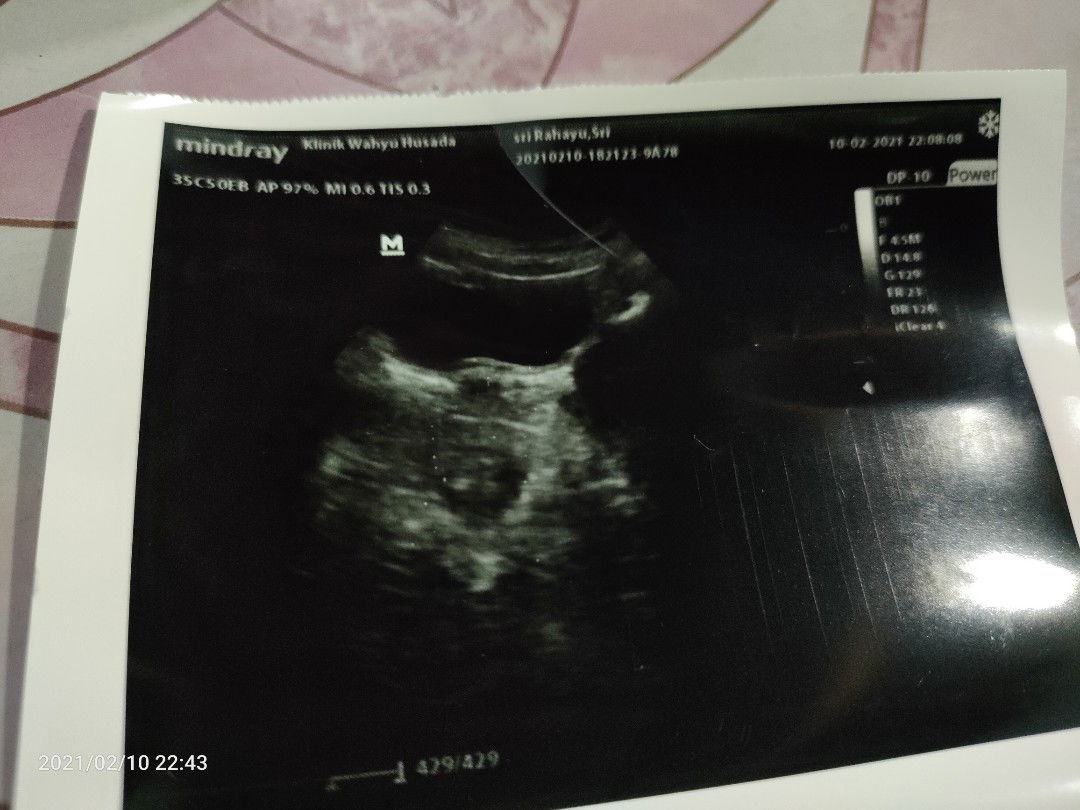 ayu tyas profile icon