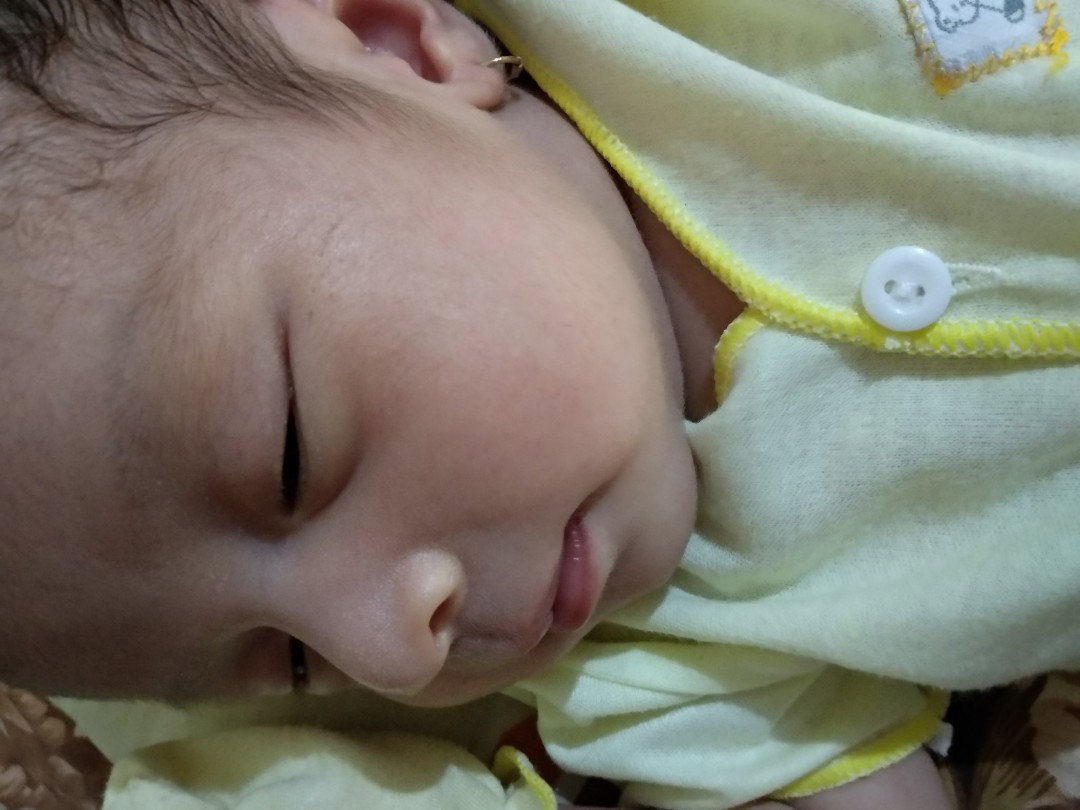 Bayi upilan terus dari 15 hari sampe sekarang 57 hari ?