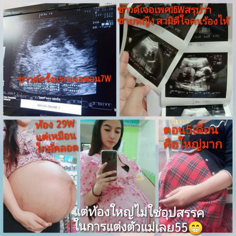 การเดินทางของแฝด
ชาย/หญิง (ธรรมชาติ)