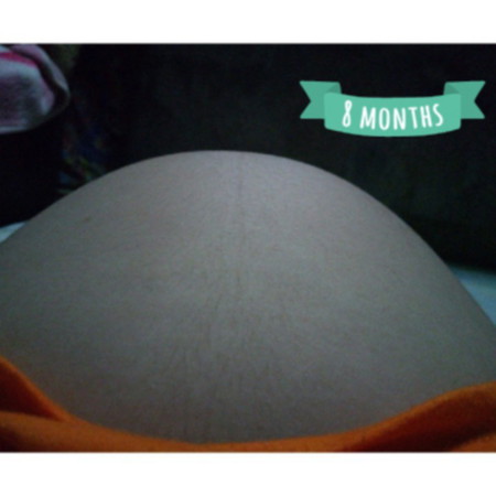 ANO PO KAYANG NANGYAYARI SA KANYA SA LOOB? ANY IDEA MGA MAMSH? KASE SOBRANG TIGAS TALAGA NIYA SA TUKTOK AND YUNG HUGIS NIYA KUNG MAPAPANSIN NIYO PO EH, NAKAUMBOK YUNG TUKTOK NG TIYAN KO.