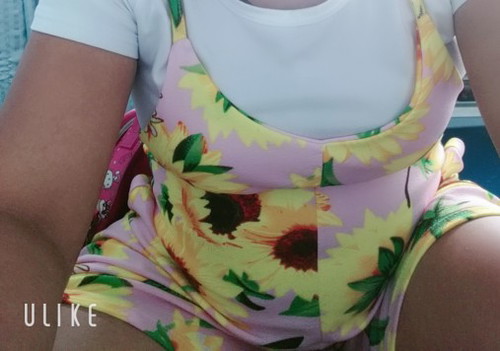 เกินกำหนดคลอด