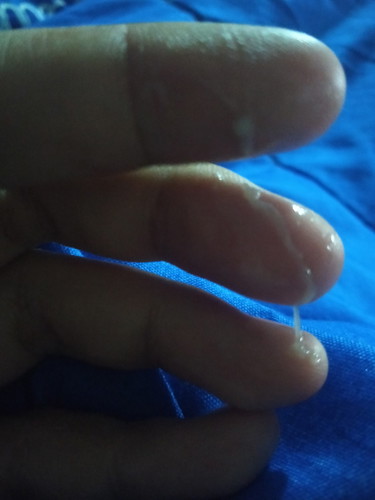 เจ็บท้อง