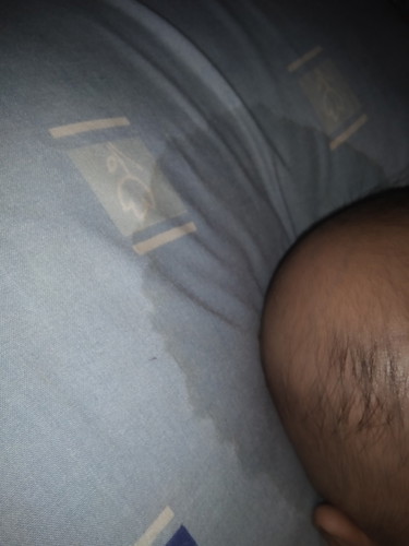 bayi sering keringatan