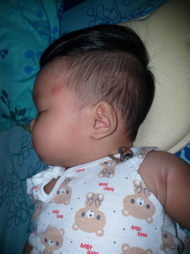 ลูกสาวตัดไถข้างมาในท้องมันจะเท่ากันไหมคะ ?