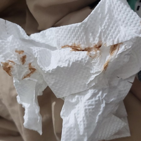 5 weeks with bleeding
