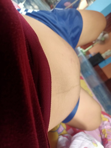 กังวลนิดหน่อย