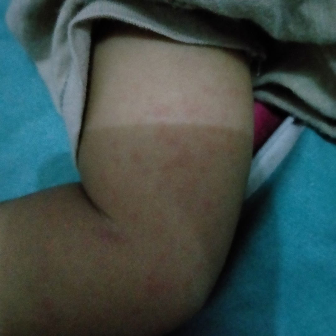 tangan dan badan biang keringat