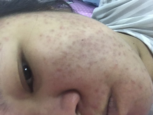 หน้าพัง