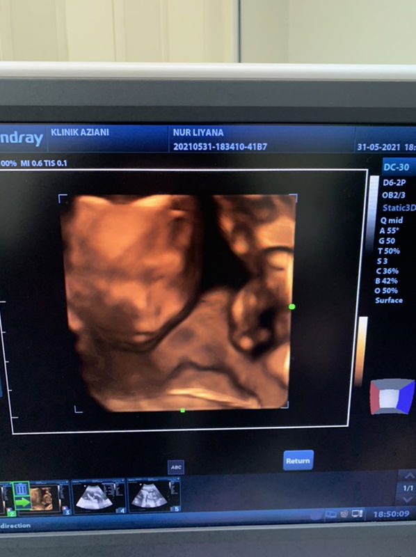 Mommy Zara profile icon