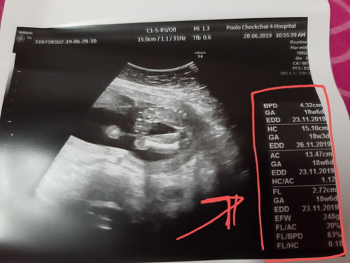 18w6d เพศหญิง