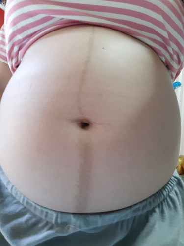 21week ลูกสาว กำหนดคลอด26พฤศจิกายนจ้า