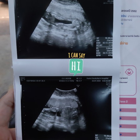 อยากถามแม่บ้านอื่นๆดูว่าน้ำหนักและส่วนสูงตามเกณฑ์ไหมคะ