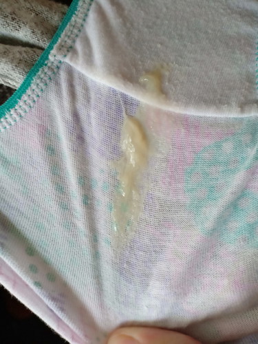 mucus