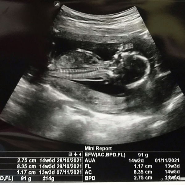 Christiani Ali profile icon