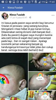 Bayi Tidak boleh dicium