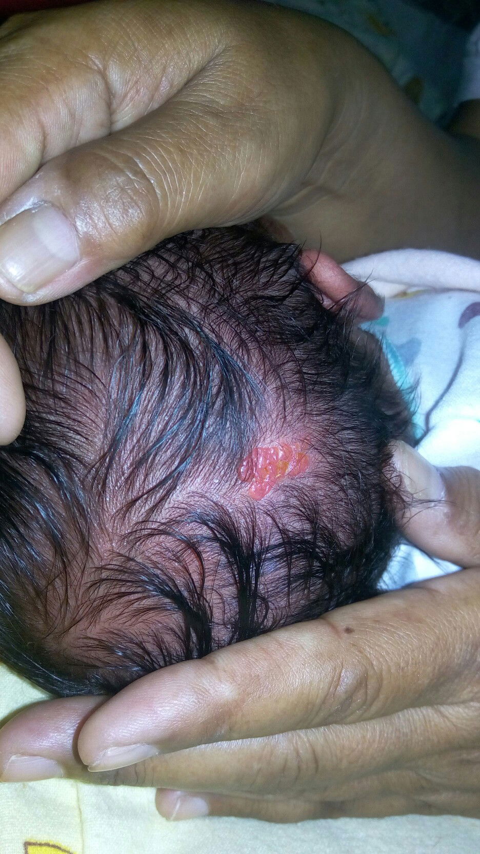 Ada yg tau g bun ini knp y..