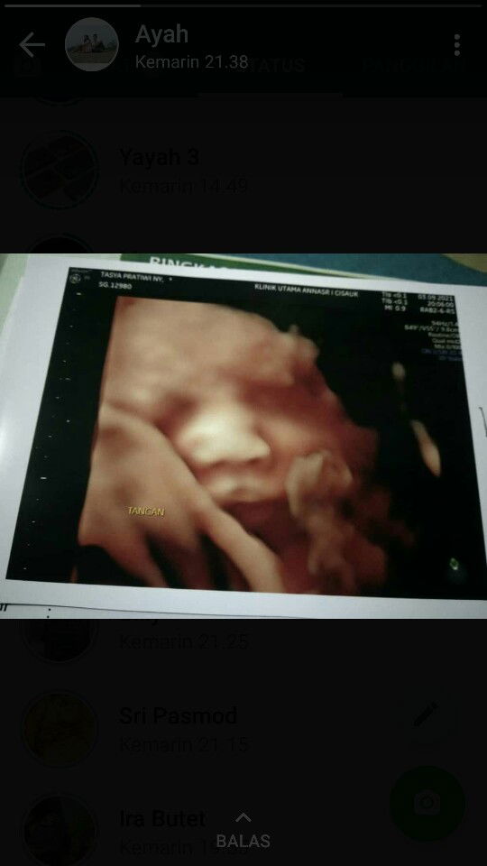 Tasya Pratiwi profile icon