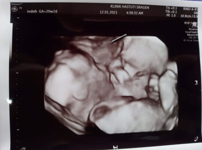 Indah febrianti profile icon