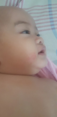 Skin ni baby