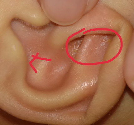 kotoran kuning kering di daun telinga