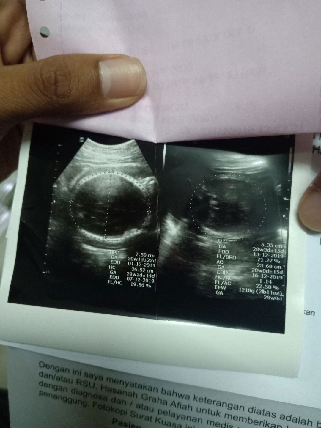 Yang bener yang mana yaa