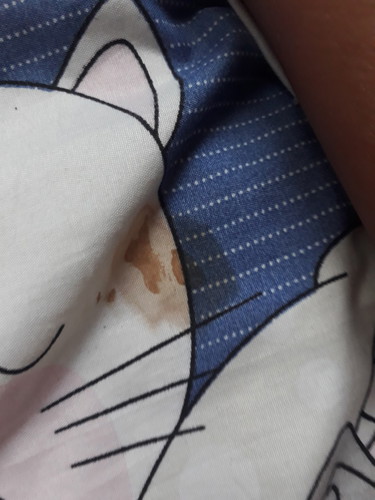 อยากถามหาประสบการค่ะ เรื่องการมีมูกเลือด