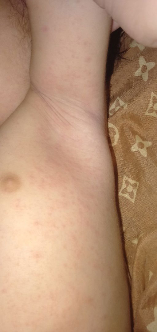 Anu po Kaya tong tumutubo sa anak ko