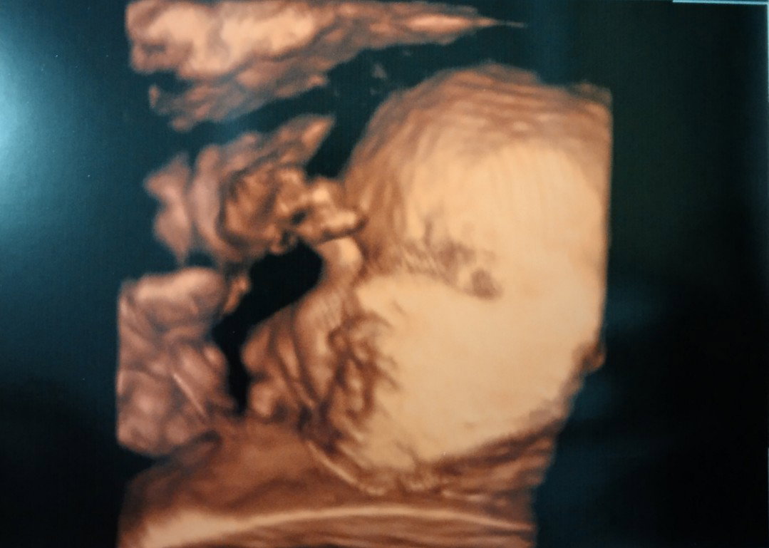Nur Azizah Septinah profile icon