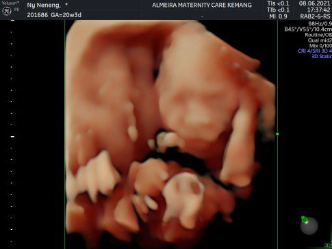 Isti Darmadi profile icon