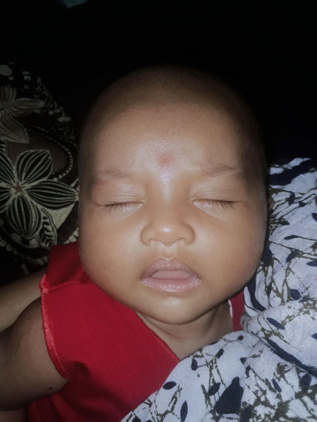 Merah di sekitar mata