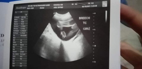 asel espino profile icon