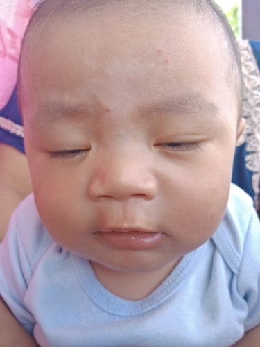 ada bintik putih di jidatnya