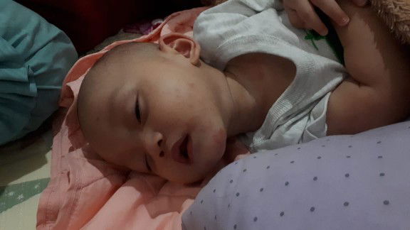 ruam merah sekujur tubuh