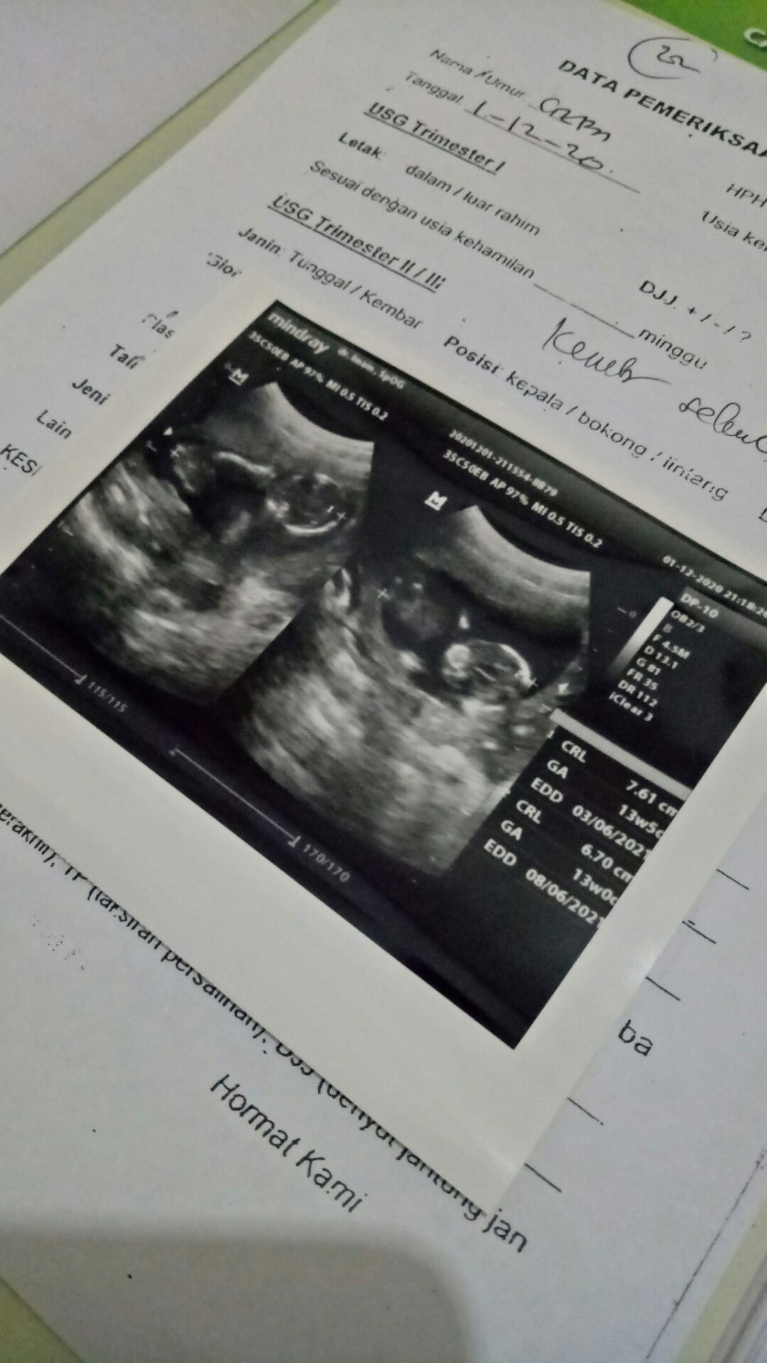 citra nur anggraeni profile icon