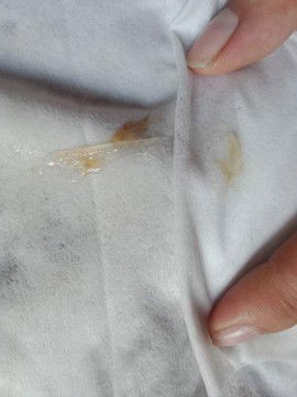 mucus plug na ba ito?