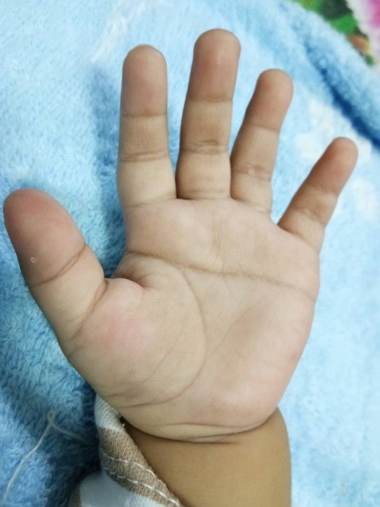 เส้นลายมือ