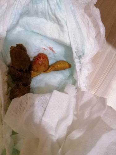 blood stain on stool